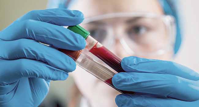 Ex�menes de sangre