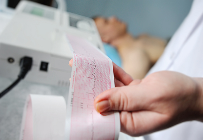 Detalle de un estudio de apnea del sue&ntilde;o