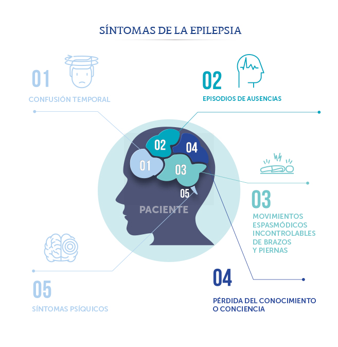 Síntomas de la Epilepsia